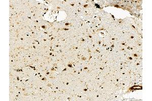 ABIN6260618 and ABIN6276638 at 1/100 staining Rat brain tissue by IHC-P.