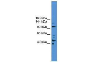 PIBF1 antibody used at 0.