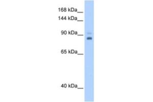 Western Blotting (WB) image for anti-TPX2, Microtubule-Associated, Homolog (Xenopus Laevis) (TPX2) antibody (ABIN2462954) (TPX2 antibody)