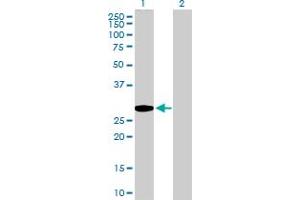 Western Blot analysis of GCLM expression in transfected 293T cell line by GCLM MaxPab polyclonal antibody. (GCLM antibody  (AA 1-274))