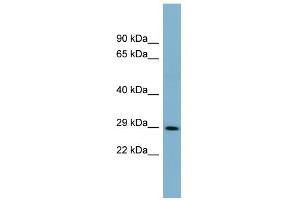 WB Suggested Anti-DCUN1D1 Antibody Titration:  0. (DCUN1D1 antibody  (Middle Region))