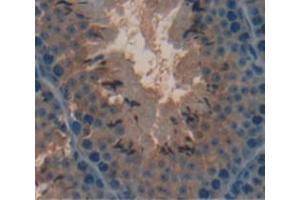 IHC-P analysis of Mouse Tissue, with DAB staining. (COMP antibody  (AA 40-180))