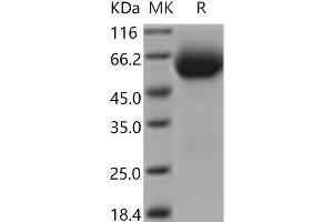 Interleukin 18 Receptor 1 (IL18R1) protein (His tag)