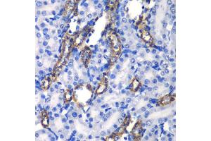 Immunohistochemistry of paraffin-embedded rat kidney using MATK antibody. (MATK antibody)