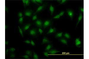 Immunofluorescence of monoclonal antibody to MAPK3 on HeLa cell. (ERK1 antibody  (AA 279-379))