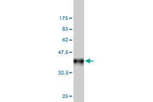 Western Blot detection against Immunogen (36. (FHIT antibody  (AA 31-130))
