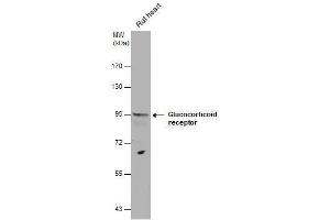 WB Image Glucocorticoid receptor antibody detects Glucocorticoid receptor protein by western blot analysis.