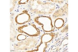 Immunohistochemistry analysis of paraffin-embedded human kidney using,CFA (ABIN7076044) at dilution of 1: 300 (TBCA antibody)