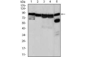 Western Blotting (WB) image for anti-Heat Shock Protein 90kDa alpha (Cytosolic), Class A Member 1 (HSP90AA1) antibody (ABIN1843961) (HSP90AA1 antibody)