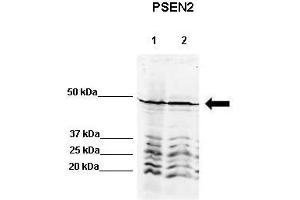 WB Suggested Anti-PSEN2 Antibody    Positive Control:  Lane 1: 80ug rat brain extract Lane 2: 80ug mouse brain extract  Primary Antibody Dilution :   1:500  Secondary Antibody :  IRDye 800 CW goat anti-rabbit from Li-COR Bioscience  Secondry Antibody Dilution :   1:20,000  Submitted by:  Dr. (Presenilin 2 antibody  (N-Term))