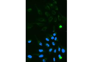 Immunofluorescence analysis of MCF7 cell using UGT1A9 antibody. (UGT1A9 antibody)