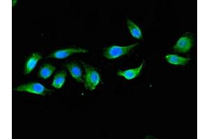 Immunofluorescent analysis of A549 cells using ABIN7150570 at dilution of 1:100 and Alexa Fluor 488-congugated AffiniPure Goat Anti-Rabbit IgG(H+L) (DOK3 antibody  (AA 1-146))