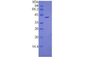 SDS-PAGE analysis of Mouse Osteocalcin Protein. (Osteocalcin Protein (BGLAP))
