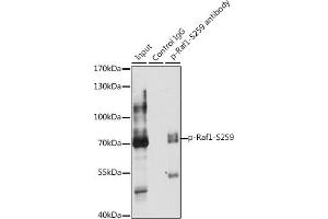 Immunoprecipitation analysis of 200 μg extracts of HeLa cells, using 3 μg Phospho-Raf1-S259 pAb (ABIN6135300, ABIN6136222, ABIN6136223 and ABIN6225538). (RAF1 antibody  (pSer259))