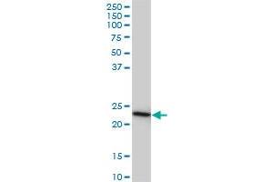 RRAS2 monoclonal antibody (M01A), clone 2D3-4B8. (RRAS2 antibody  (AA 1-204))