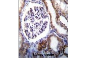 IFT88 Antibody (C-term) (ABIN655090 and ABIN2844723) immunohistochemistry analysis in formalin fixed and paraffin embedded human kidney tissue followed by peroxidase conjugation of the secondary antibody and DAB staining. (IFT88 antibody  (C-Term))