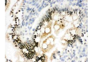 IHC analysis of RbAp48 using anti-RbAp48 antibody . (Retinoblastoma Binding Protein 4 antibody  (C-Term))