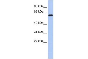 WB Suggested Anti-KLHL7 Antibody Titration: 0. (KLHL7 antibody  (Middle Region))