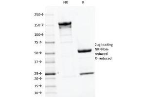 SDS-PAGE Analysis of Purified, BSA-Free PTH Antibody (clone PTH/1175). (PTH antibody  (AA 32-115))