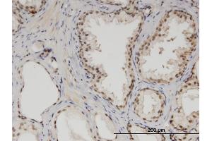 Immunoperoxidase of monoclonal antibody to MED6 on formalin-fixed paraffin-embedded human prostate. (MED6 antibody  (AA 1-246))