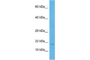 Host:  Rabbit  Target Name:  NDUFB11  Sample Tissue:  Human HepG2 Whole Cell  Antibody Dilution:  1ug/ml (NDUFB11 antibody  (N-Term))