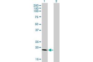 Western Blot analysis of SSR4 expression in transfected 293T cell line by SSR4 monoclonal antibody (M01), clone 2D3.