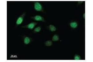 Immunostaining analysis in HeLa cells. (TWIST1 antibody)