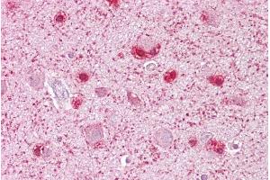 Immunohistochemistry with Brain, cortex tissue at an antibody concentration of 5µg/ml using anti-MCM3 antibody (ARP36644_P050) (MCM3 antibody  (C-Term))