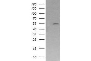 Image no. 1 for anti-Mdm4-binding Protein (MDM4) antibody (ABIN1499360)
