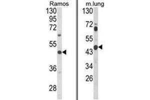 (LEFT) Western blot analysis of CXCR7 Antibody (C-term) in Ramos cell line lysates (35ug/lane). (CXCR7 antibody  (C-Term))