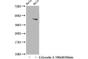 Western Blot Positive WB detected in Hela whole cell lysate(treated with Calyculin A or not) All lanes Phospho-MAPT antibody at 1. (Recombinant MAPT antibody  (pThr231))