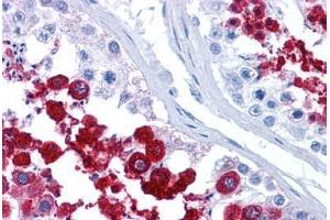 Human Testis: Formalin-Fixed, Paraffin-Embedded (FFPE) (YBX2 antibody  (C-Term))