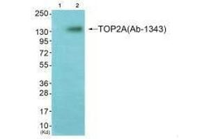 Western blot analysis of extracts from K562 cells (Lane 2), using TOP2A (Ab-1343) antiobdy. (Topoisomerase II alpha antibody  (Thr1343))