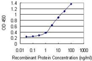 Detection limit for recombinant GST tagged FLT3 is 0. (FLT3 antibody  (AA 91-190))