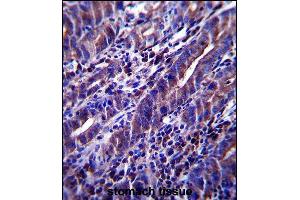 MUC1/E Antibody (C-term) (ABIN657546 and ABIN2846561) immunohistochemistry analysis in forlin fixed and paraffin embedded hun stoch tissue followed by peroxidase conjugation of the secondary antibody and DAB staining. (MUC1 antibody  (C-Term))