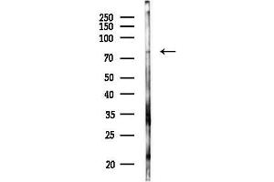 Western blot analysis of lysates from EC304 cells(UV 30 min treatment), using CLIC6 Antibody at 1/1000 dilution.