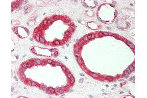 Human Kidney: Formalin-Fixed, Paraffin-Embedded (FFPE). (HMGCS1 antibody  (C-Term))