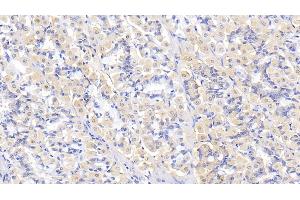 Detection of THBS2 in Human Stomach Tissue using Polyclonal Antibody to Thrombospondin 2 (THBS2) (Thrombospondin 2 antibody  (AA 968-1172))