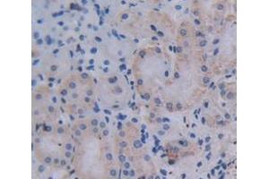 Figure. (Cathepsin K antibody  (AA 113-316))