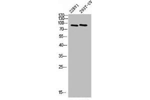 Western Blot analysis of 293T-UV 22RV1 cells using PML Polyclonal Antibody (PML antibody  (N-Term))