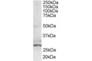 Western Blotting (WB) image for anti-HIV-1 Tat Interactive Protein 2, 30kDa (HTATIP2) (N-Term) antibody (ABIN2466379) (HIV-1 Tat Interactive Protein 2, 30kDa (HTATIP2) (N-Term) antibody)