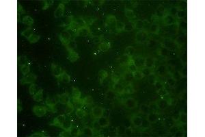 Image no. 3 for anti-RAP2B, Member of RAS Oncogene Family (RAP2B) (AA 1-184) antibody (ABIN598571) (RAP2B antibody  (AA 1-184))