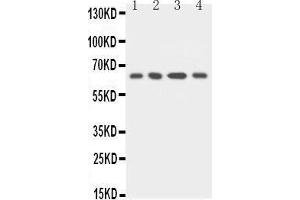 Anti-uPA Receptor antibody, Western blotting Lane 1: MCF-7 Cell Lysate Lane 2: HELA Cell Lysate Lane 3: RAJI Cell Lysate Lane 4: SMMC Cell Lysate