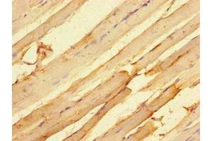 Immunohistochemistry of paraffin-embedded human skeletal muscle tissue using ABIN7172733 at dilution of 1:100