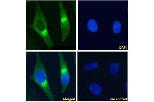 Immunofluoresence staining of fixed HeLa cells with anti-Beta-2 microglobulin antibody BBM. (Recombinant beta-2 Microglobulin antibody)