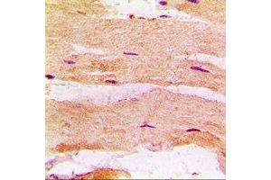 Immunohistochemical analysis of MBNL1 staining in rat heart formalin fixed paraffin embedded tissue section. (MBNL1 antibody)