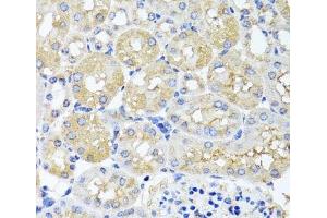 Immunohistochemistry of paraffin-embedded Mouse kidney using HARS2 Polyclonal Antibody at dilution of 1:100 (40x lens). (HARS2 antibody)