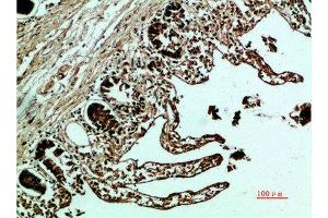 Immunohistochemical analysis of paraffin-embedded human-colon, antibody was diluted at 1:200 (Fibronectin 1 antibody  (AA 1268-1341))