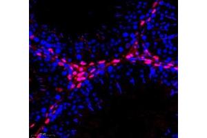 Immunofluorescence (Paraffin-embedded Sections) (IF (p)) image for anti-Transketolase (TKT) antibody (ABIN7075978)