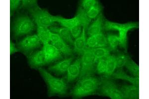 Immunocytochemistry/Immunofluorescence analysis using Mouse Anti-GABA A Receptor Monoclonal Antibody, Clone S151-3 . (GABRA1 antibody  (AA 15-34) (PE))